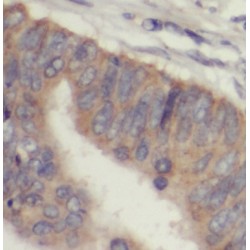 Interleukin 1 Receptor Antagonist (IL1RN) Antibody
