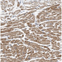 Interleukin 1 Receptor Accessory Protein Like 1 (IL1RAPL1) Antibody
