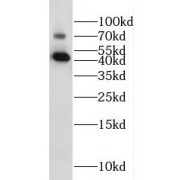 WB analysis of MCF7 cells, using IL20RB antibody (1/500 dilution).