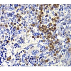 Interleukin 21 (IL21) Antibody