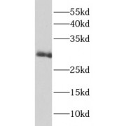 WB analysis of MCF7 cells, using IL22RA2 antibody (1/600 dilution).