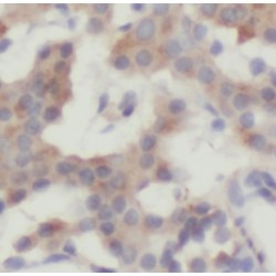 Interleukin 23 (IL23A) Antibody