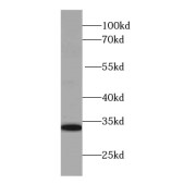 WB analysis of Recombinant protein, using IL28A antibody (1/5000 dilution).
