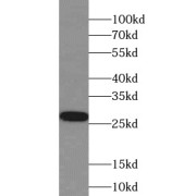 WB analysis of Transfected HEK-293 cells, using IL37 antibody (1/2000 dilution).