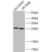 WB analysis of Recombinant protein, using Il6 antibody (1/600 dilution).