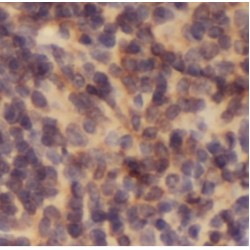 Interleukin 6 Receptor (IL6R) Antibody