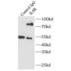Interleukin 6 Receptor (IL6R) Antibody
