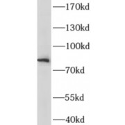 WB analysis of Jurkat cells, using IL6R antibody (1/800 dilution).