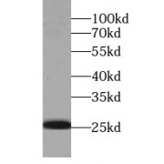 WB analysis of human plasma (0.3ug) tissue, using IgG light chain (Kappa) antibody (1/1000 dilution).