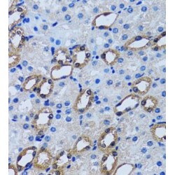 Inositol Monophosphatase 1 (IMPA1) Antibody