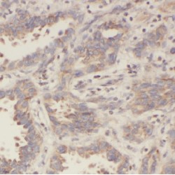 Inosine 5'-Monophosphate Dehydrogenase 2 (IMPDH2) Antibody