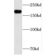 WB analysis of A431 cells, using INF2 antibody (1/500 dilution).