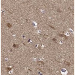 ING4-specific Antibody