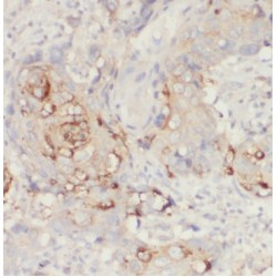 Inhibin Beta A (INHBA) Antibody