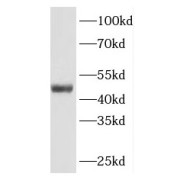 WB analysis of A549 cells, using INHBA antibody (1/1000 dilution).