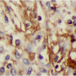 Inhibin Beta A (INHBA) Antibody