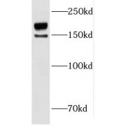 WB analysis of HeLa cells, using INO80 antibody (1/600 dilution).