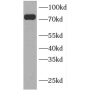 WB analysis of mouse spleen tissue, using INPP5B antibody (1/200 dilution).