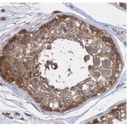 72 kDa Inositol Polyphosphate 5-Phosphatase (INPP5E) Antibody