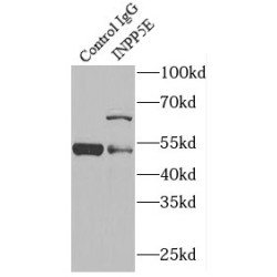 72 kDa Inositol Polyphosphate 5-Phosphatase (INPP5E) Antibody
