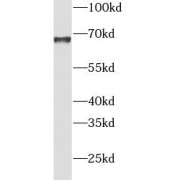 WB analysis of SH-SY5Y cells, using INPP5E antibody (1/1000 dilution).