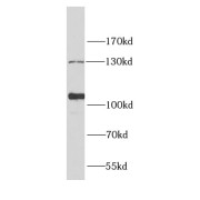 WB analysis of human heart tissue, using INPP5J antibody (1/1000 dilution).