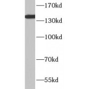 WB analysis of Jurkat cells, using ITGA4 antibody (1/1000 dilution).