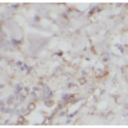 Integrin Beta 6 (ITGB6) Antibody