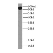 WB analysis of A549 cells, using ITGB6-Specific antibody (1/500 dilution).