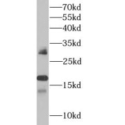 WB analysis of HL60 cells, using Interferon Alpha-1 antibody (1/1000 dilution).
