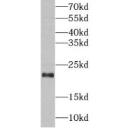 abx234357