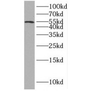 WB analysis of human kidney tissue, using IP6K1 antibody (1/300 dilution).