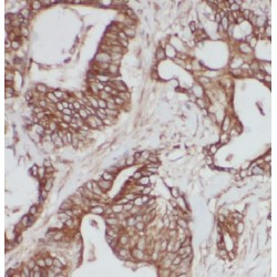 IQ Domain-Containing Protein K (IQCK) Antibody