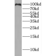 WB analysis of mouse lung tissue, using IREB2 antibody (1/300 dilution).