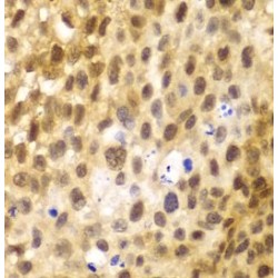 Interferon Regulatory Factor 3 (IRF3) Antibody