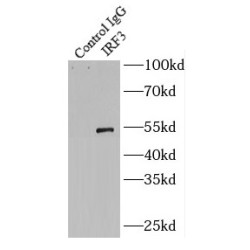 Interferon Regulatory Factor 3 (IRF3) Antibody