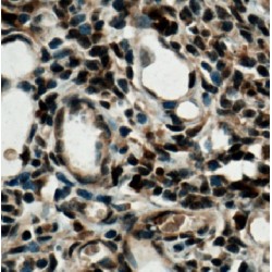 Interferon Regulatory Factor 4 (IRF4) Antibody