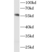 WB analysis of HeLa cells, using IRF5 antibody (1/1000 dilution).
