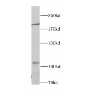 WB analysis of A549 cells, using IRS1 antibody (1/1000 dilution).