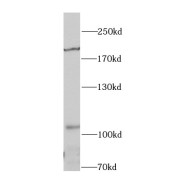 WB analysis of A549 cells, using IRS1 antibody (1/1000 dilution).