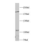 WB analysis of A549 cells, using IRS1 antibody (1/1000 dilution).