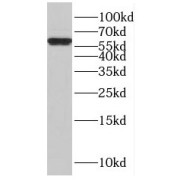 WB analysis of HepG2 cells, using ISYNA1 antibody (1/400 dilution).