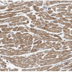 Integrin Beta-1-Binding Protein 1 (ITGB1BP1) Antibody