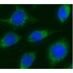 Integrin Beta 1 Binding Protein 2 (ITGB1BP2) Antibody