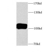 WB analysis of mouse brain tissue, using ITPKB antibody (1/1000 dilution).