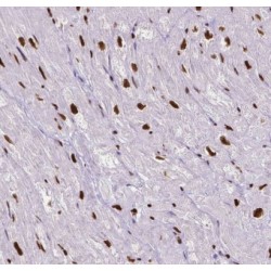 Inositol-Trisphosphate 3-Kinase C (ITPKC) Antibody