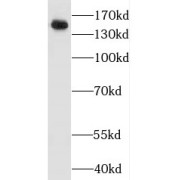 WB analysis of HeLa cells, using Jagged 2 antibody (1/500 dilution).