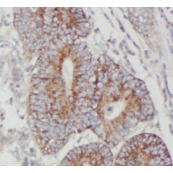 Junction Mediating And Regulatory Protein (JMY) Antibody