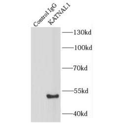 Katanin Catalytic Subunit A1 Like 1 (KATNAL1) Antibody