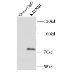 Katanin Regulatory Subunit B1 (KATNB1) Antibody
